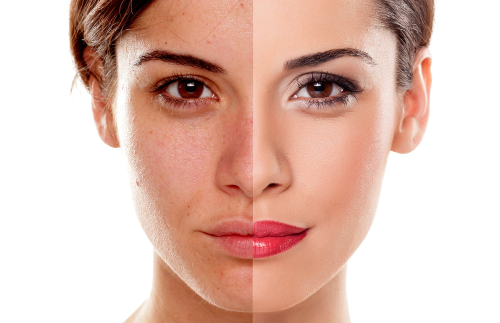 WHAT TO CONSIDER WHEN CHOOSING THE RIGHT SKIN CARE PRODUCTS FOR YOURSELF